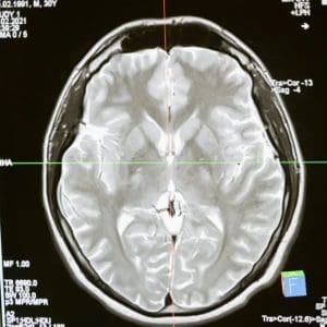 Head X-ray scan